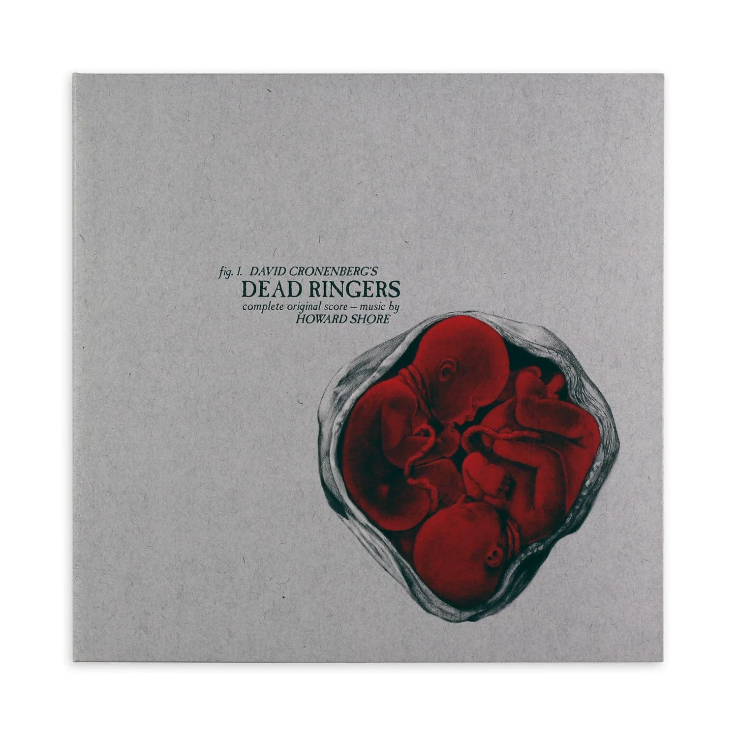 Dead Ringers – Original Motion Picture Soundtrack LP (Version B)